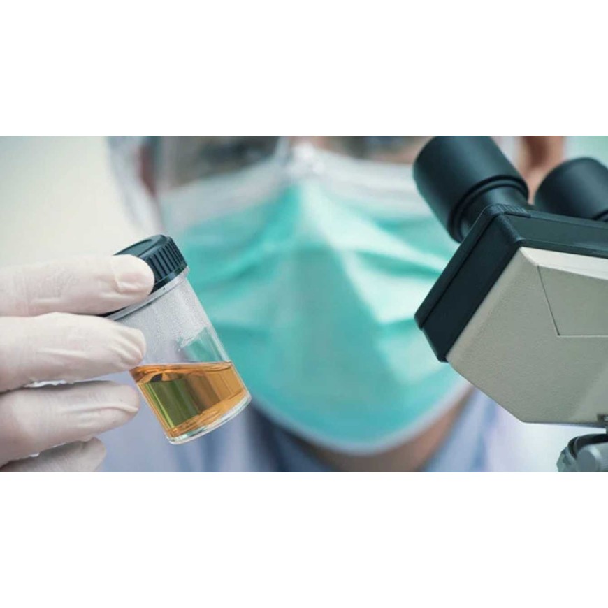 Nos astuces pour réussir son test urinaire THC et récupérer son permis !