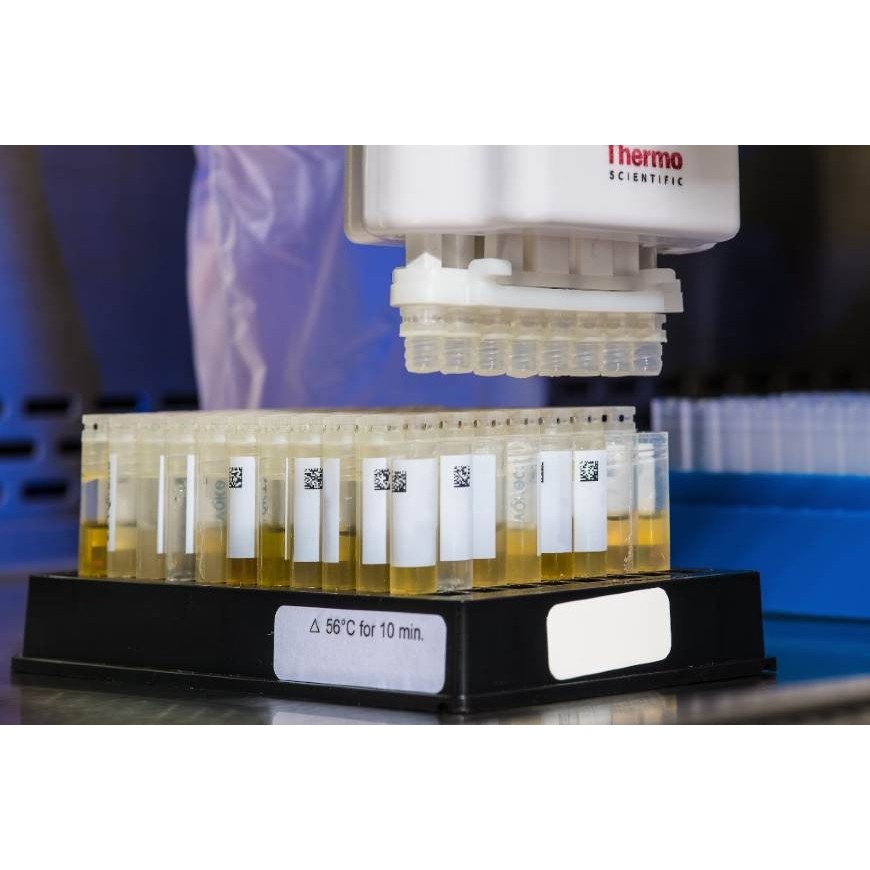 Tests antidrogues : lequel choisir ?